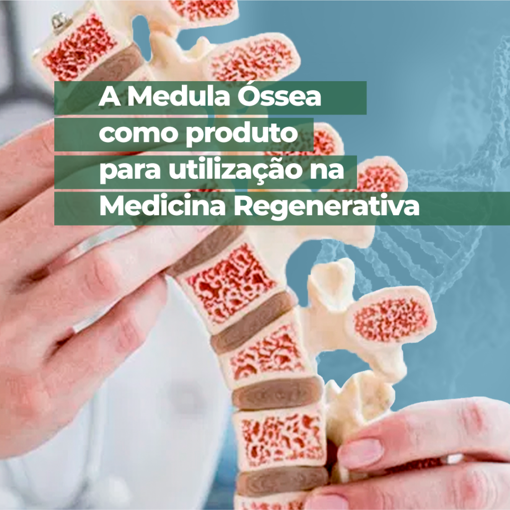 a-medula-ossea-como-produto-para-utilizacao-na-medicina-regenerativa