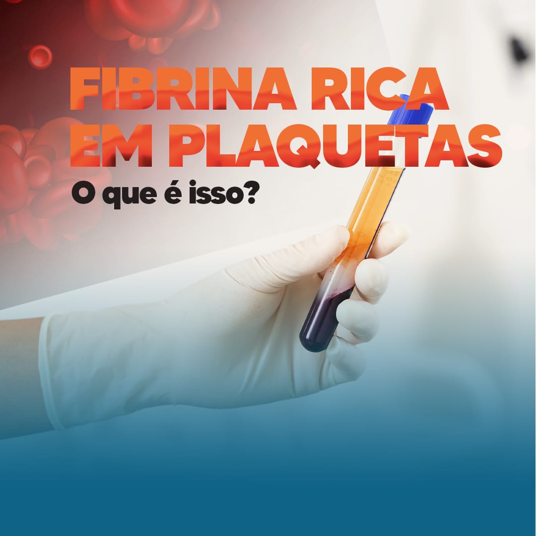 fibrina-rica-em-plaquetas-–-o-que-e-isso?